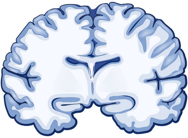 A graphic of a normal brain without Alzheimer's