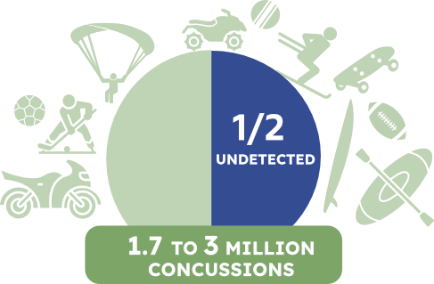 sports concussion examples